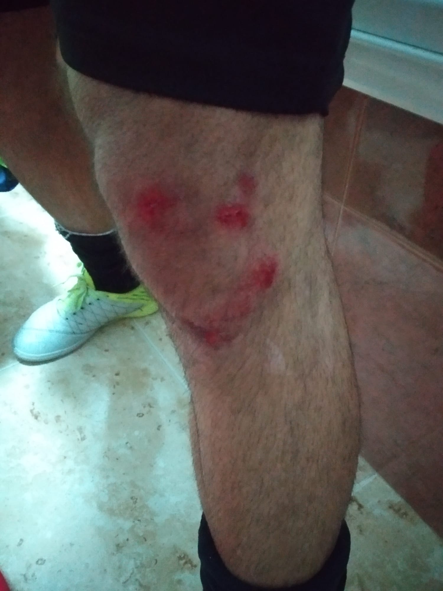 Compromís per Vila-real denuncia que el mal estado del parquet del polideportivo Sebastián Mora causa daños a los deportistas
